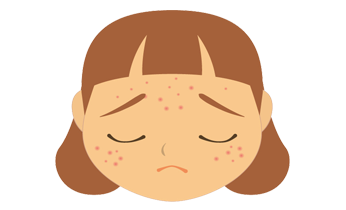 Acne Homeopathy Treatment Acne Homeopathy Treatment