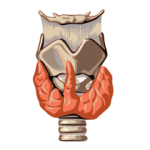 Hyper Thyroidism Homeopathy Treatment