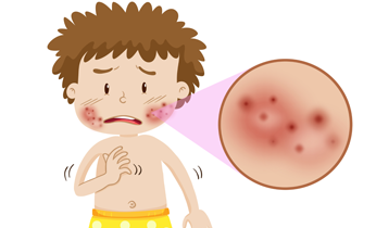 Skin Disease Skin Disease