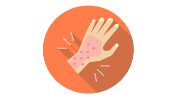 Skin Infection Homeopathy Treatment Skin Infection Homeopathy Treatment
