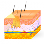 Wart Homeopathy Treatment